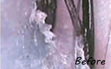 毛根断面図 before photo